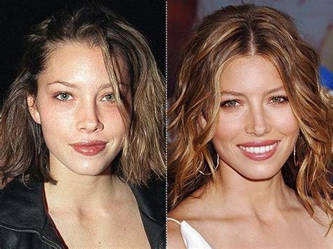 Jessica Biel Nose Job Before And After Photos Nose Job Celebrity