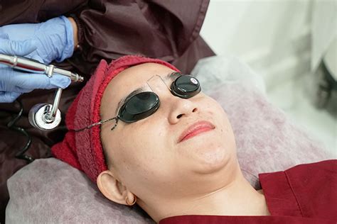 Tengok Rekomendasi Klinik Kecantikan Di Bandung Dengan Treatment