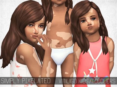 Sims 4 Mm Cc Maxis Match Vitiligo For Children And