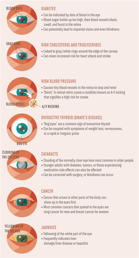 eye health facts eye facts health info health and nutrition opthalmic technician iridology