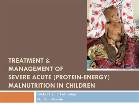 Difference Between Severe Acute Malnutrition And Protein Energy