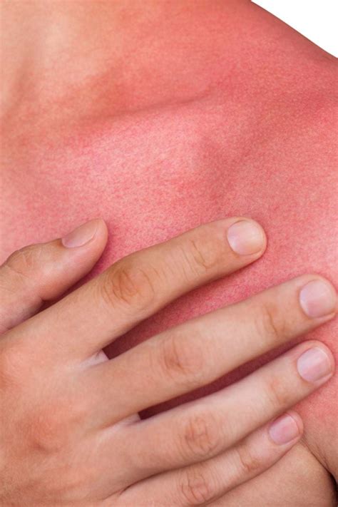 Skin Redness Causes And When To See A Doctor