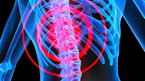 The Most Common Symptoms Of Spinal Cord Injury Lets Blog Health