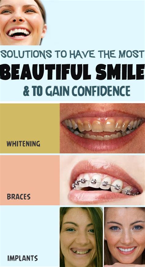How To Have A Beautiful Smile Beautiful Smile Beauty Remedies Diy Beauty Routines