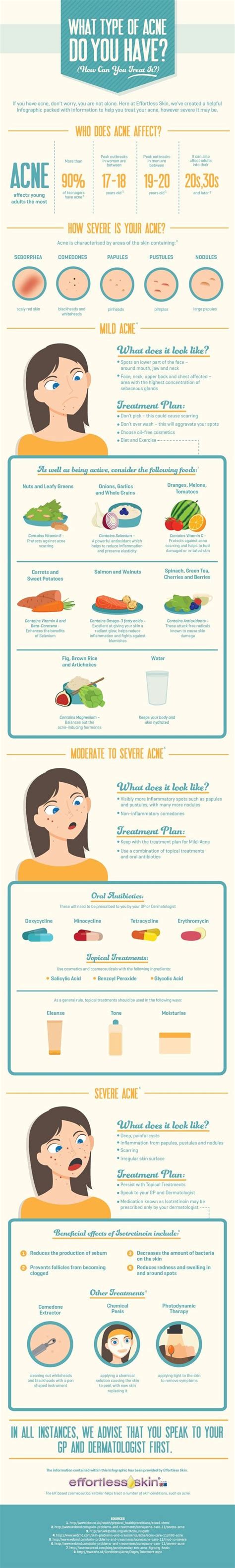 What Type Of Acne Do You Have Genius Acne Infographics That