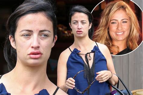 Chantelle Houghton Sparks Concern As She Shows Off Huge Pout Before