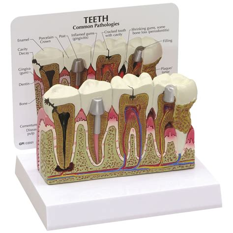 Teeth Model 1019539 2860 Anatomical Tooth Models Anatomy Teaching Models Dentistry