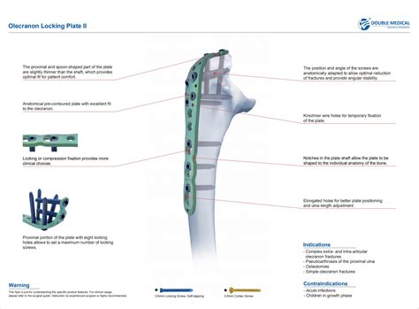 Olecranon Locking Plate Ⅱmedical Device Manufacturers Double Medical