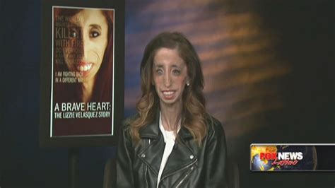 Lizzie Velasquez Once ‘worlds Ugliest Woman Now Among The Bravest