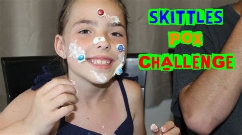 The Skittles Pox Challenge Youtube