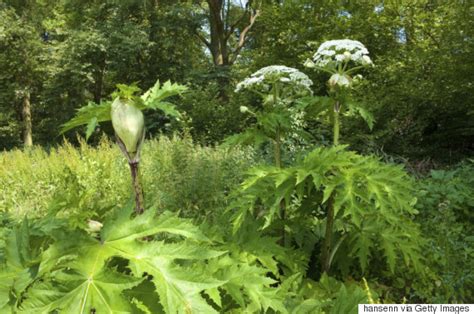 Giant Hogweed Burns Treatment What Should You Do If You Touch The