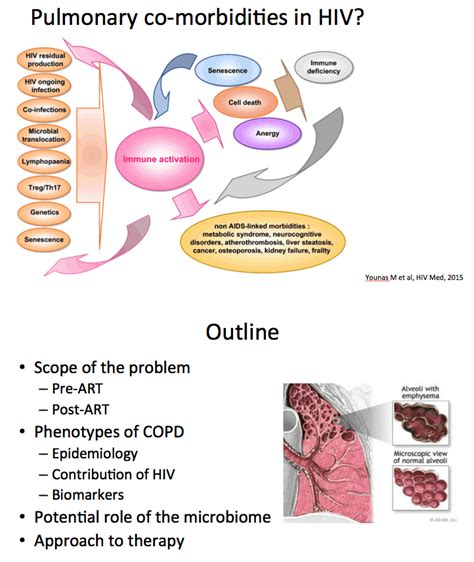 Lung Disease In Hiv Causes And Consequences