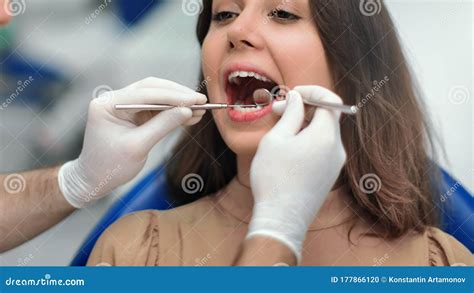 Close Up Face Of Woman With Open Mouth During Teeth Checkup At