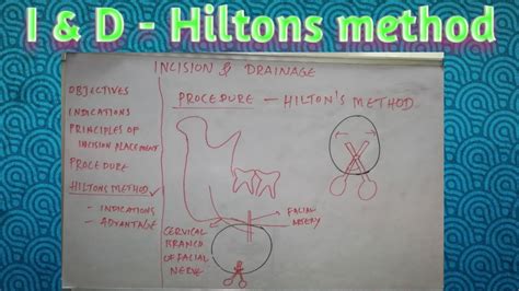 Incision And Drainage Hiltons Method Of Abscess Drainage Youtube