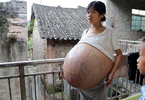 Revealing The Unbelievable A Woman S Kg Uncontrollably Big Belly Reveals Unbelievably