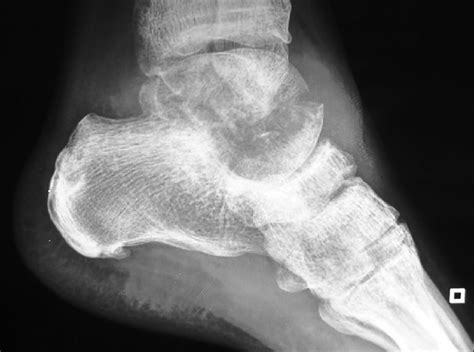 Read Online Radiology Of The Foot And Ankle Download Free Free