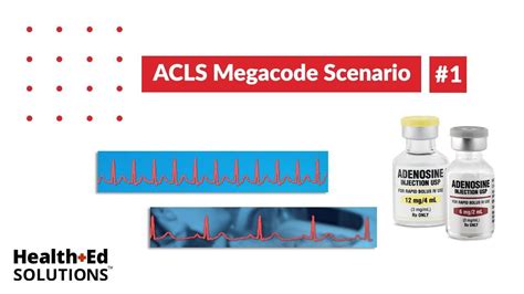 Acls Megacode Scenario 1 Supraventricular Tachycardia Svt In 2022