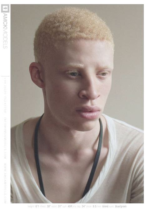 Pin By Maria Johnson On Beautiful People Albino Model Albinism Albino Men