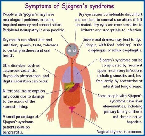 32 Best Sjogrens Syndrome Images On Pinterest Chronic Illness