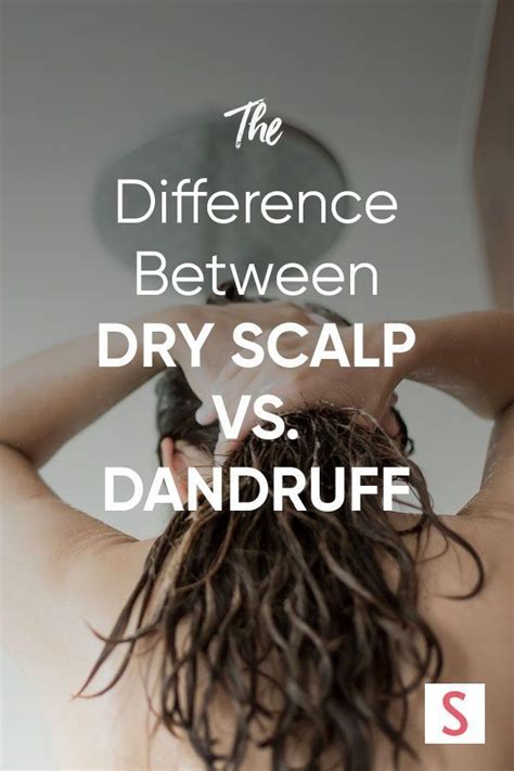 Are Dandruff And Dry Scalp The Same Thing Dry Scalp Treatment Dandruff Vs Dry Scalp Dry Scalp