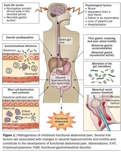 Abdominal Pain Location Chart - ovulation symptoms
