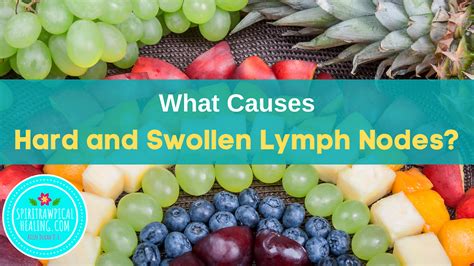 How To Heal Swollen Lymph Nodes