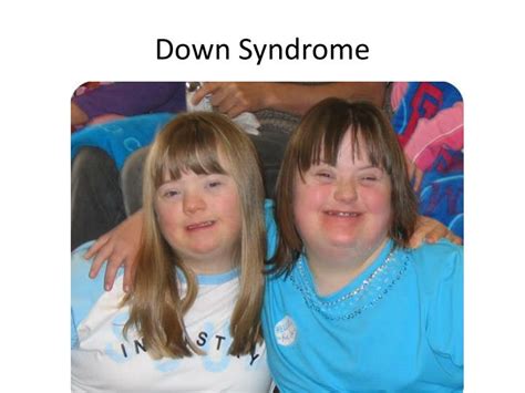 Most babies inherit 23 chromosomes from each parent, for a total of 46 chromosomes. PPT - Down Syndrome ( trisomy 21) PowerPoint Presentation ...
