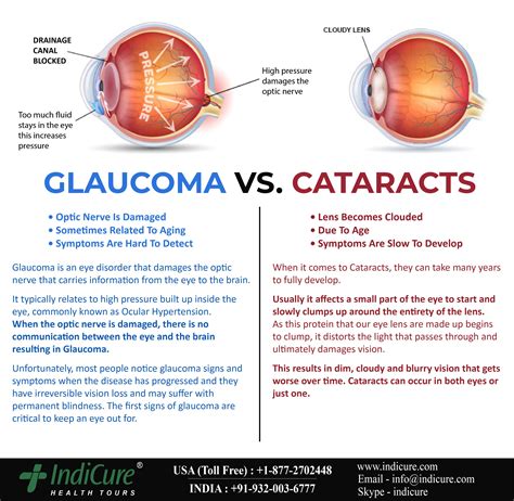 Glaucoma Symptoms Causes Types Treatment Artofit