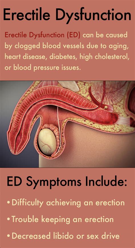 Erectile Dysfunction Treatment What Causes ED Symptoms Shockwave