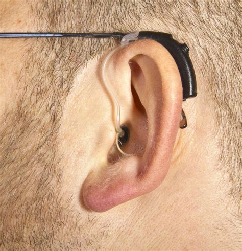 What Is A Tinnitus Hearing Aid With Pictures