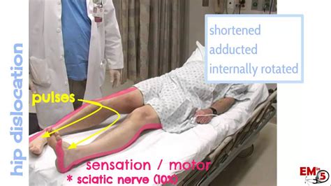 Video Hip Dislocation Assessment And Treatment