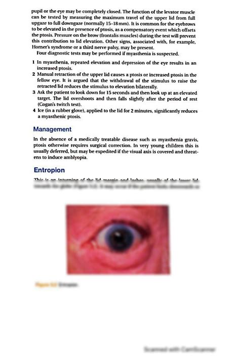 Solution Abnormalities Of Eyelids Studypool