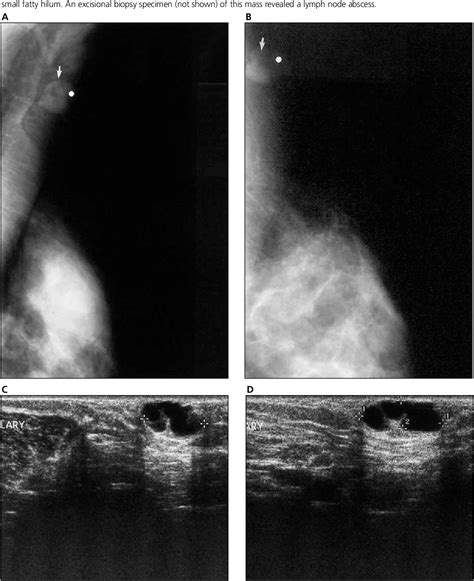 Pdf Sonographic Evaluation Of Isolated Abnormal Axillary Lymph Nodes