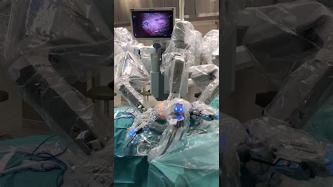 Live Robotic Hernia Surgery Youtube