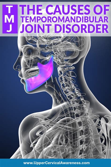 Origin Of Temporomandibular Joint Disorder Temporomandibular Joint