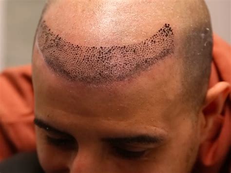 Update More Than 75 Men S Hairline Tattoo Latest In Eteachers