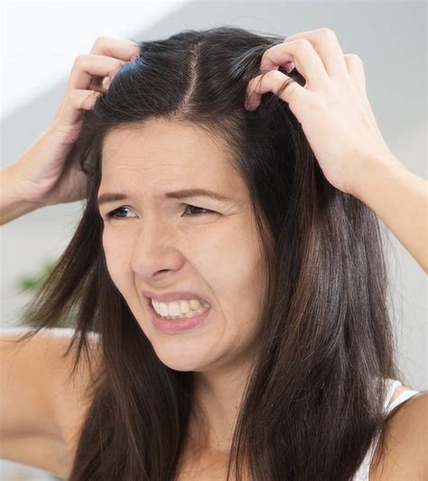 Itchy Scalp The Common Cuases And Treatment To Get Rid Of It