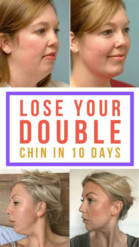 How To Get Rid Of A Double Chin The Quick And Easy Way In A Week