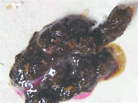 What does it mean when your dog keeps. Mucus Stool With Blood - Goldenacresdogs.com