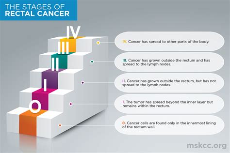 Stages Of Rectal Cancer Memorial Sloan Kettering Cancer Center