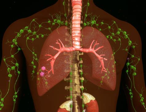 Targeting Certain Lymph Nodes Could Change Mesothelioma Treatment