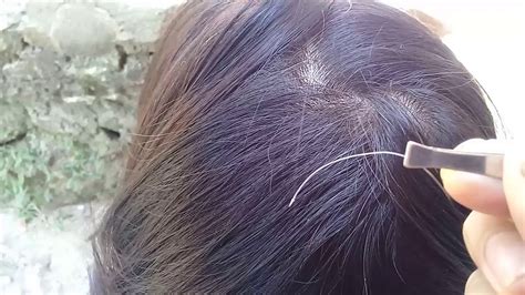 Pulling Out A White Hair From Your Head Causes More