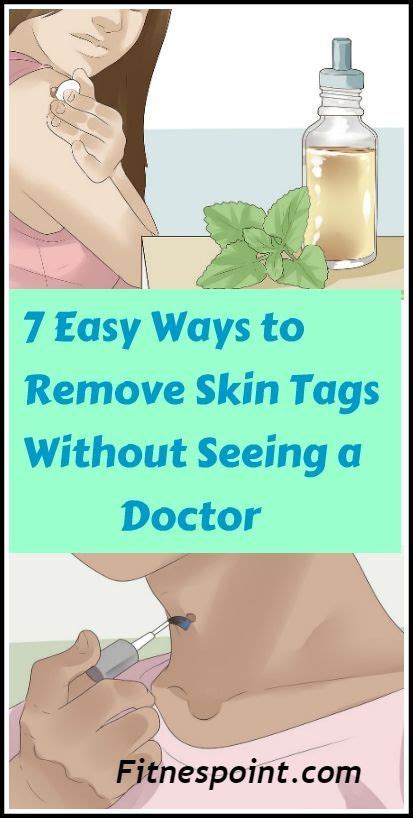 7 easy ways to remove skin tags without seeing a doctor skin tag removal skin tags home