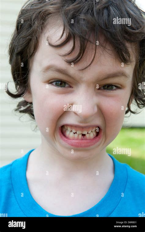 Boy Grimacing Showing Missing Tooth Portrait Stock Photo Alamy