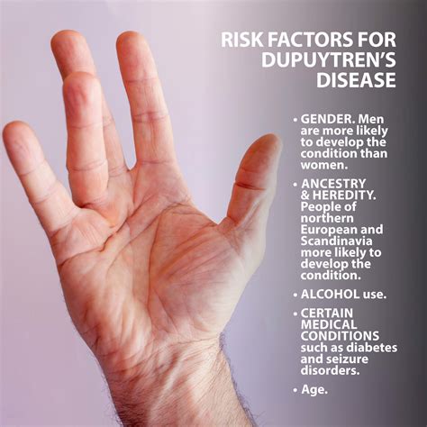 Dupuytrens Contracture Risk Factors Philadelphia Holistic Clinic