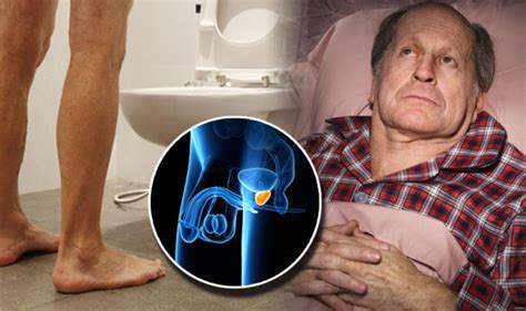 Prostate Cancer Seven Symptoms Of The Disease Revealed Health Life Style Express Co Uk