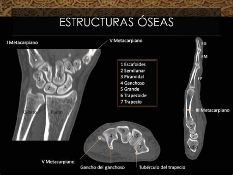 Anatomía De La Muñeca Y Mano Atlas RadiolÓgico Semantic Scholar