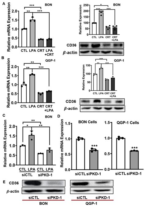 Cells Free Full Text Protein Kinase D1 Signaling In Cancer Stem