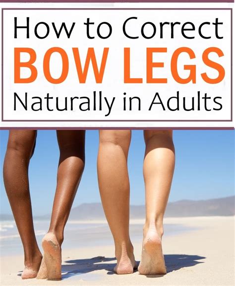 How To Correct Bow Legs Naturally In Adults How To Correct Bow Legs