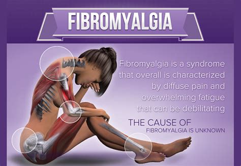 fibromyalgia [infographic] visualistan